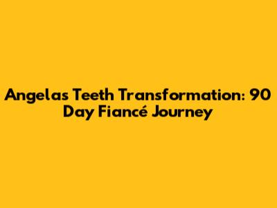 Angela's Teeth Transformation: 90 Day Fiancé Journey