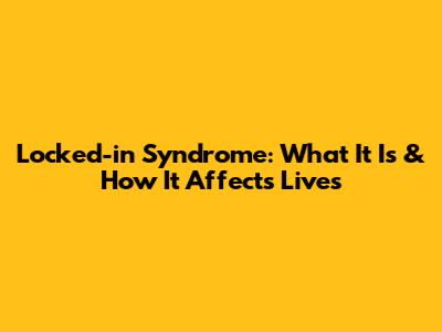 Locked-in Syndrome: What It Is & How It Affects Lives