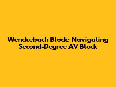 Wenckebach Block: Navigating Second-Degree AV Block